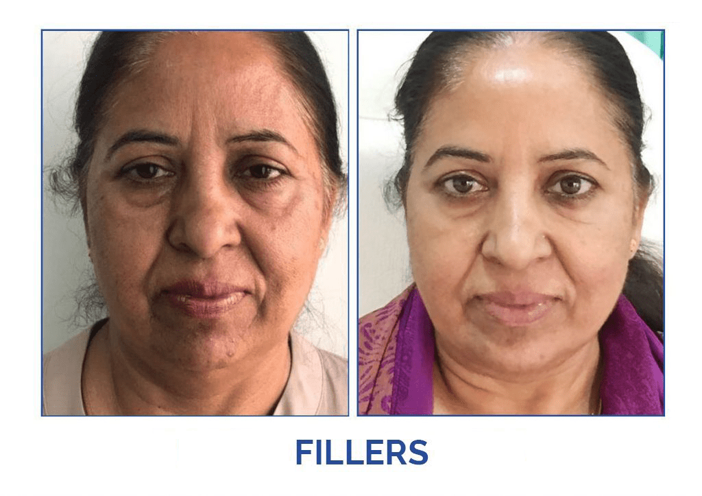 Dental Cosmetic Clinic - Dr Shobit sethi
